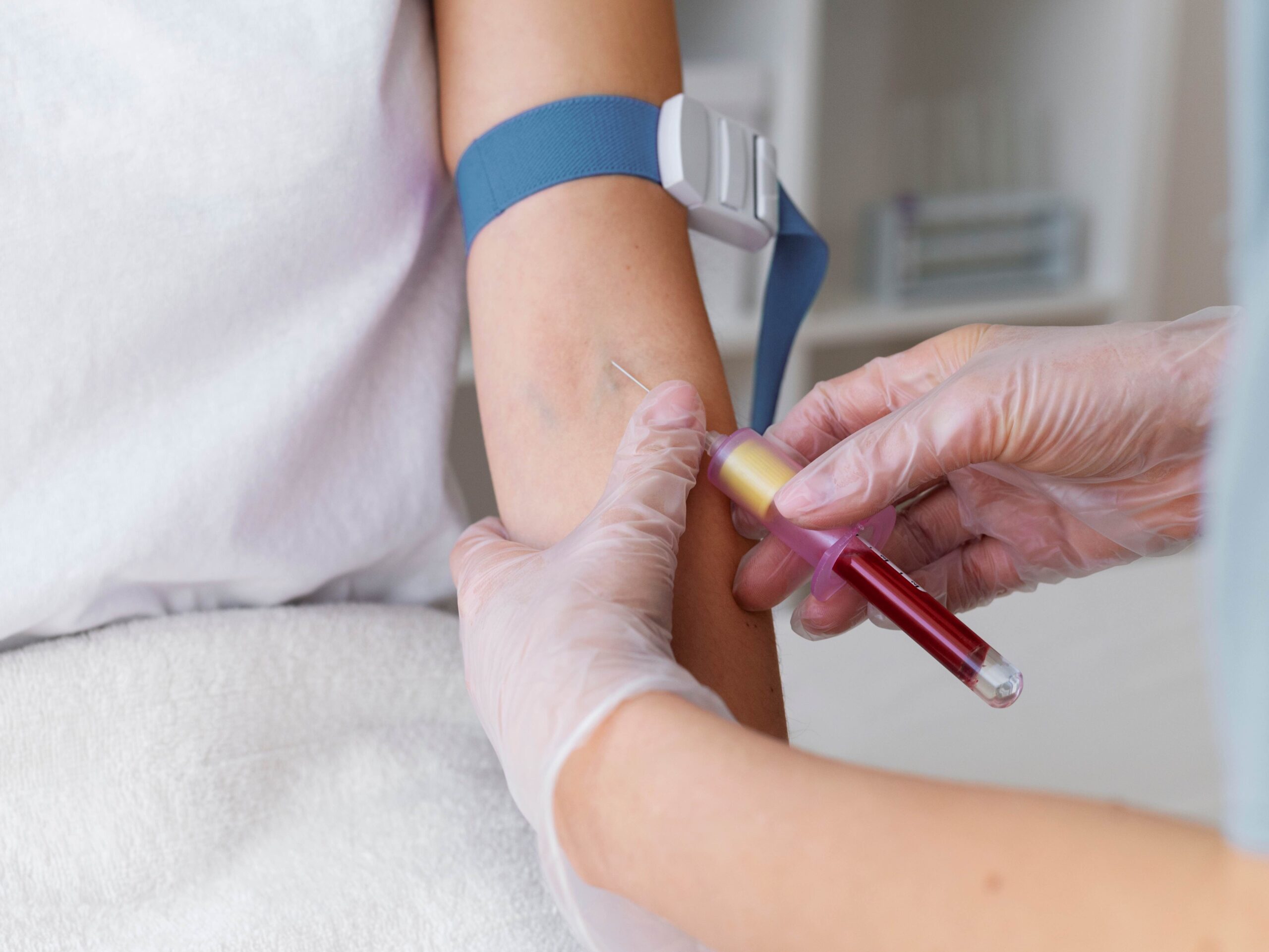 Blood Test Bali – Fast, Accurate, and Professional Laboratory Testing for Tourists, Expats, and Residents 3 blood-test-bali