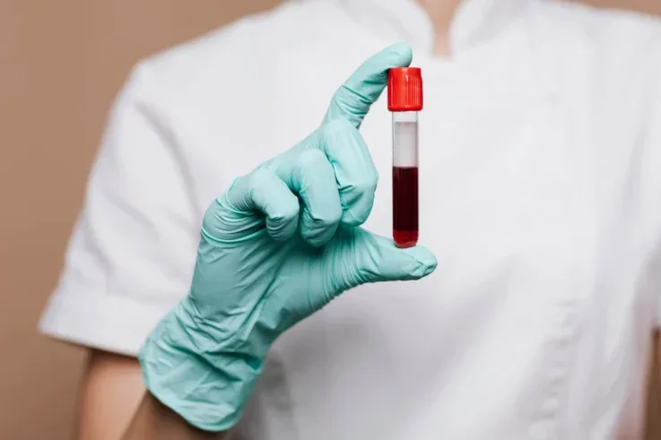 Blood Test Bali – Fast, Accurate, and Professional Laboratory Testing for Tourists, Expats, and Residents 5 blood-test-bali