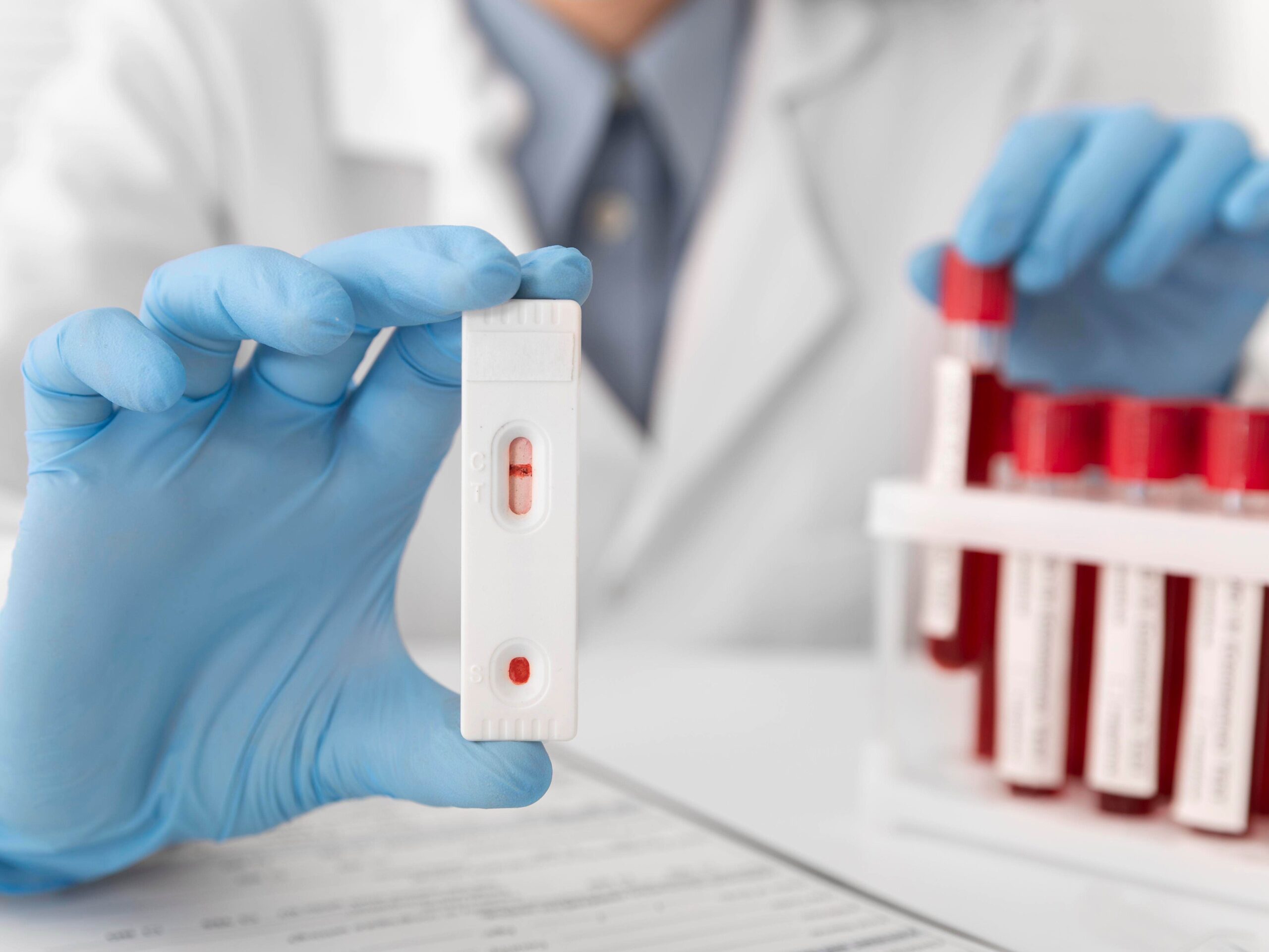 HIV Test Bali – Confidential and Professional HIV Testing for Tourists, Expats, and Residents 4 hiv-test-bali