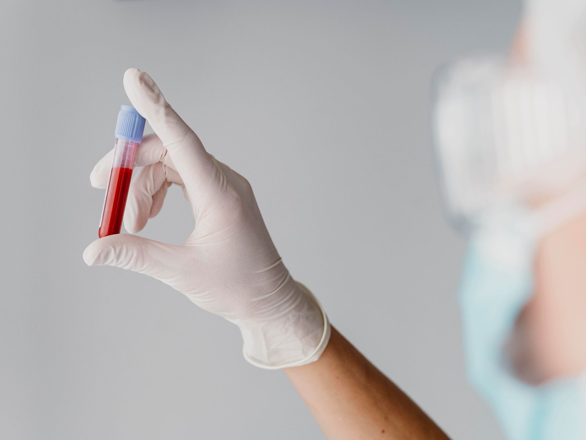 STD Test Bali – Confidential & Professional Sexual Health Testing 3 std-test-bali