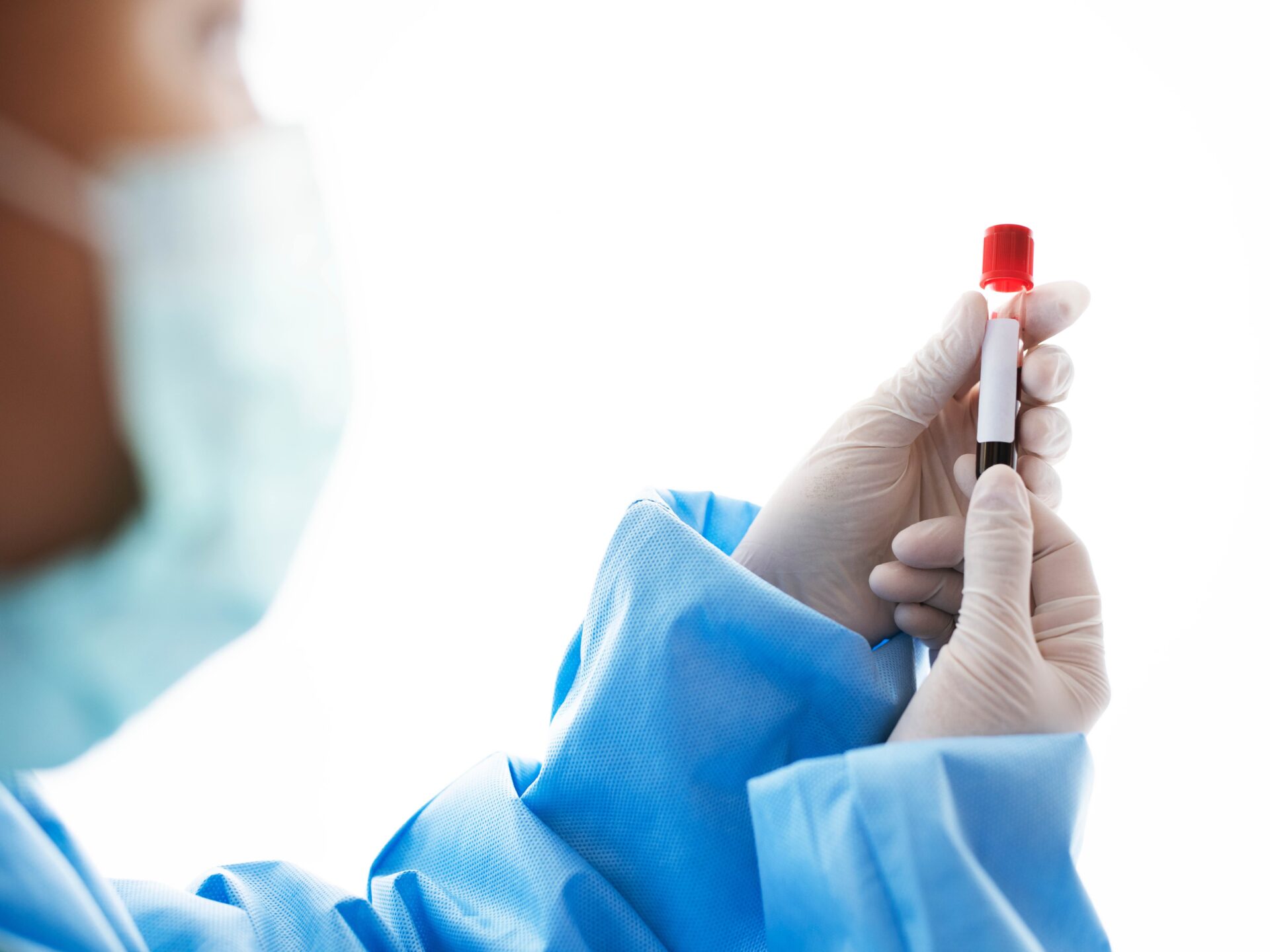 STD Test Bali – Confidential & Professional Sexual Health Testing 5 std-test-bali